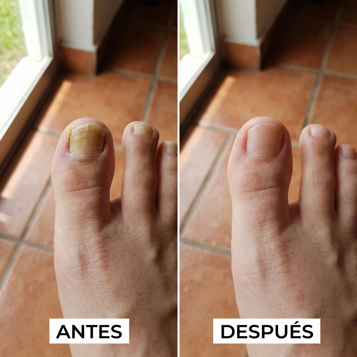 PARCHES ANTIHONGOS EEUU 🗽